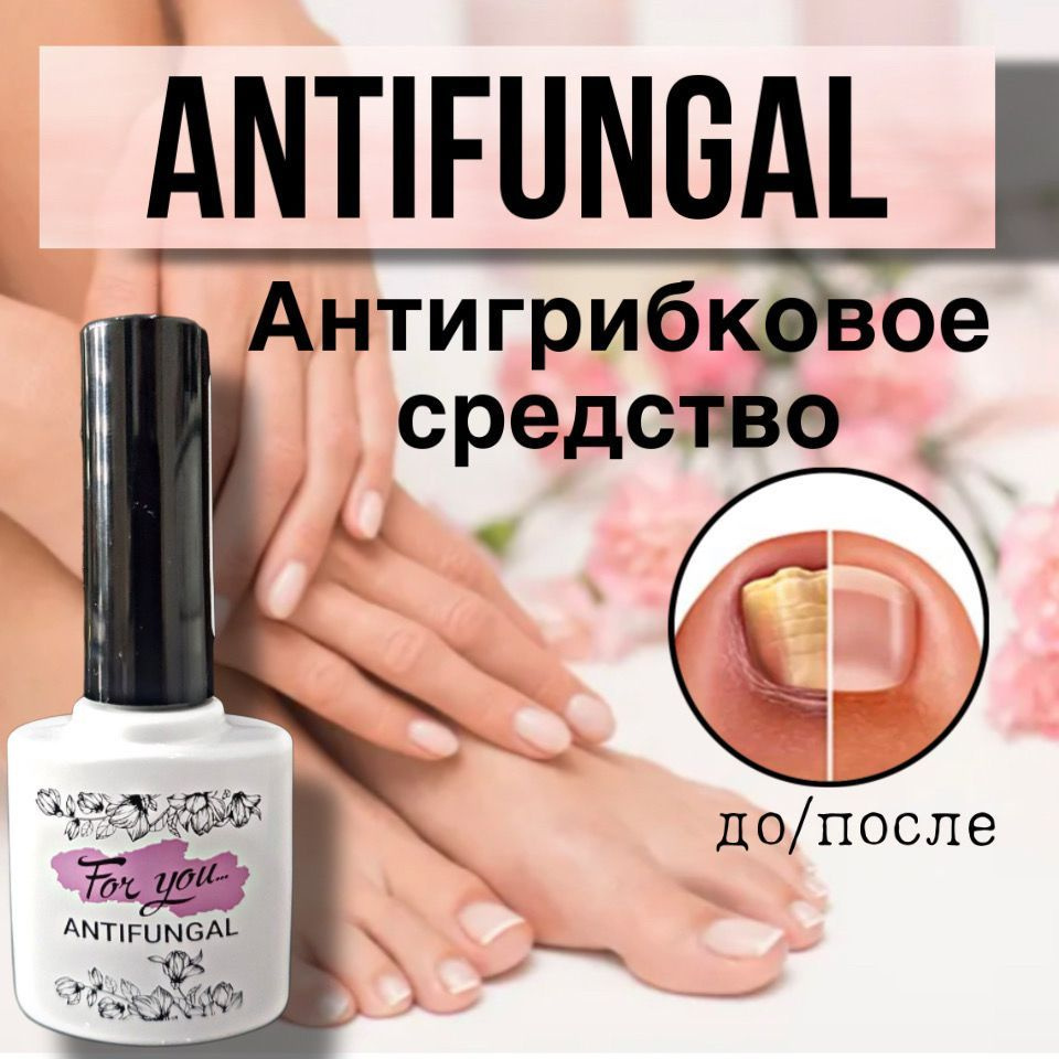Антигрибковое средство для ногтей FOR YOU "Antifungal", 15мл. #1