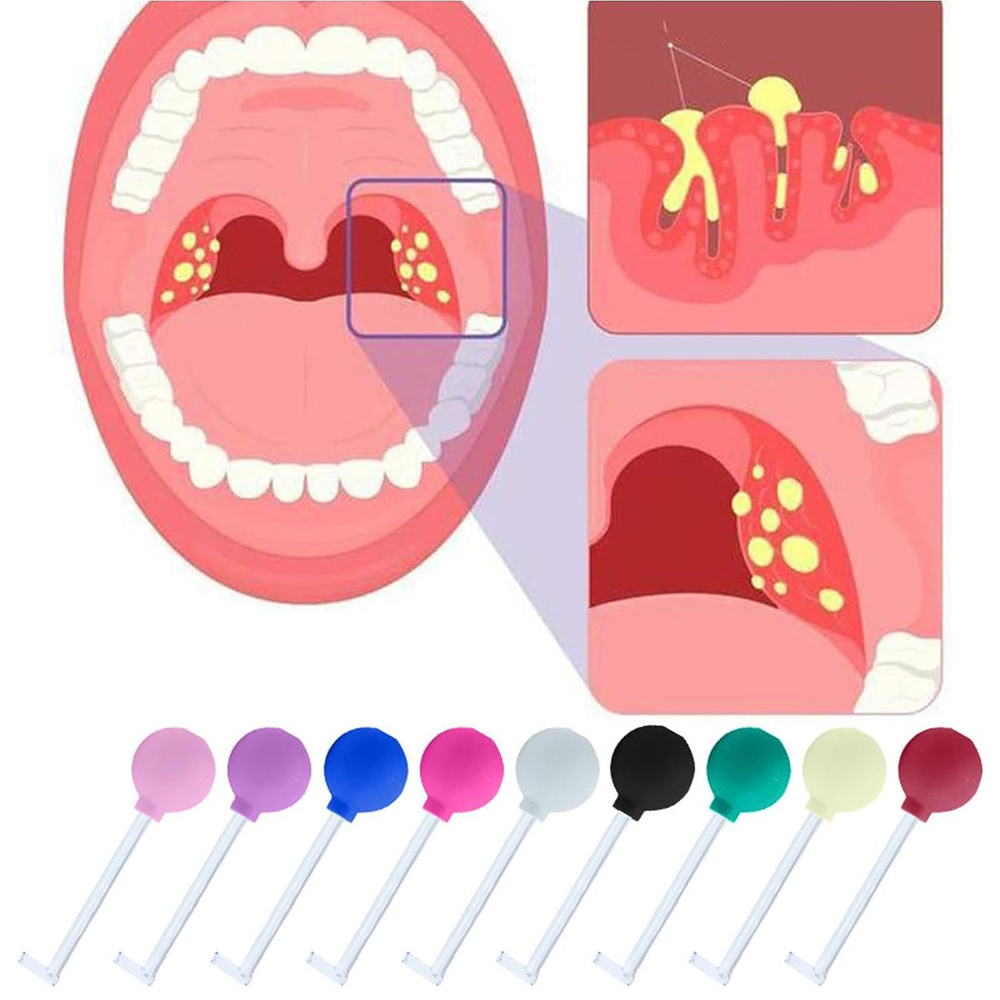 Инструмент для устранения миндалин, инструмент для забора миндалин с присоской из ПВХ, очиститель рта #1