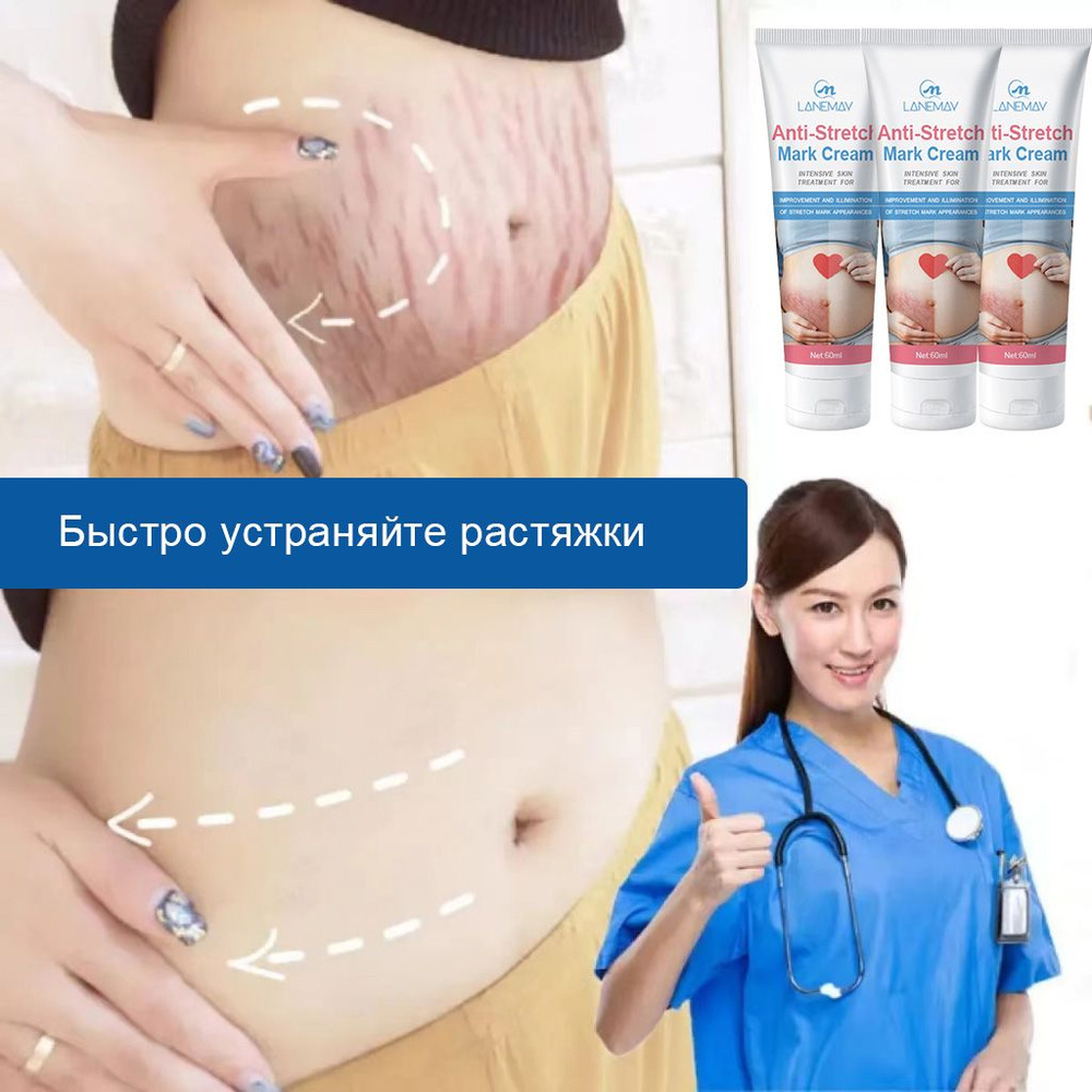Крем от растяжек для беременных 60мл питательное увлажняющее средство по уходу за кожей против растяжек #1