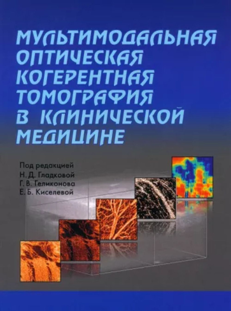 Мультимодальная оптическая когерентная томография в клинической медицине  #1