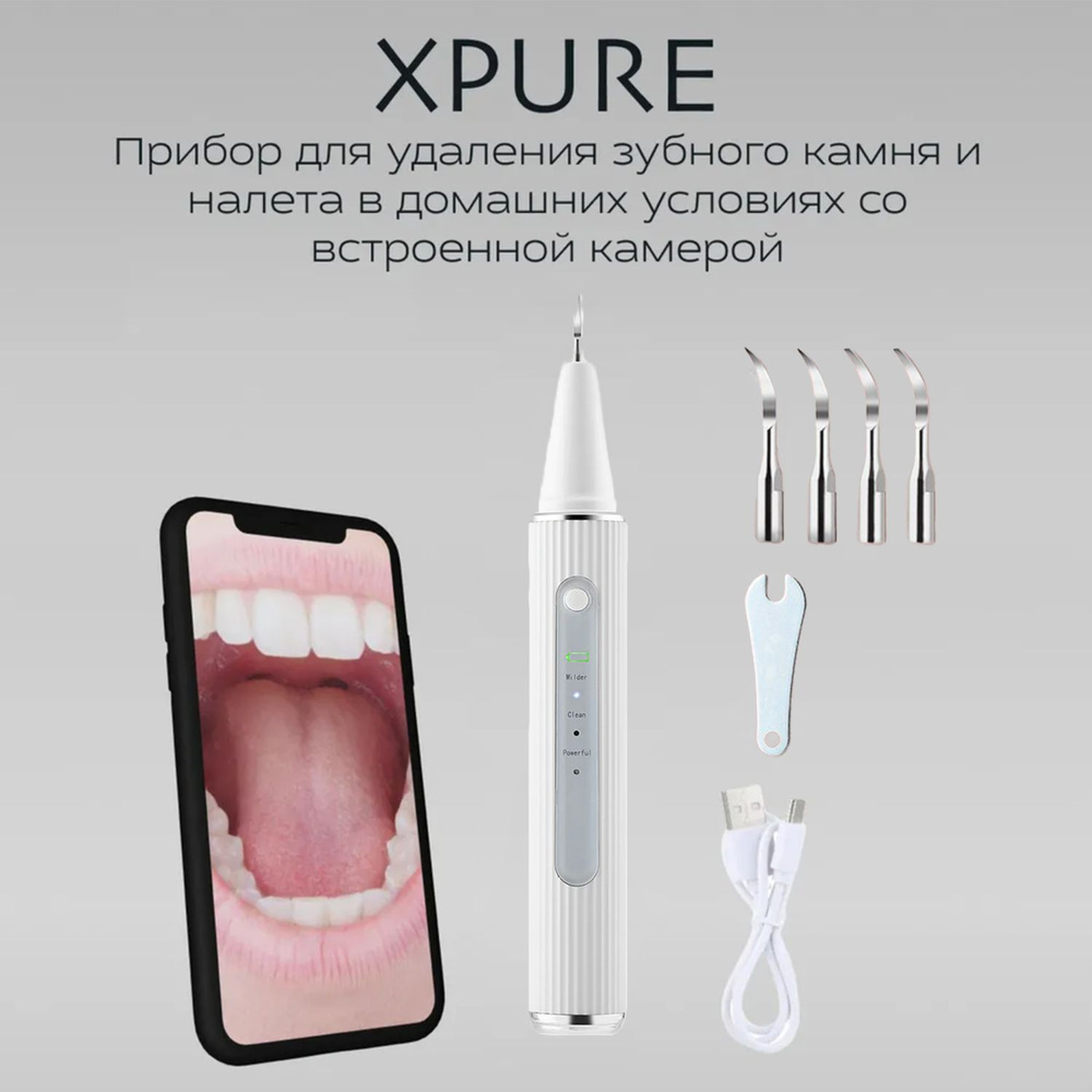Удаление зубного камня и налета в стоматологии в Киеве, Теремки