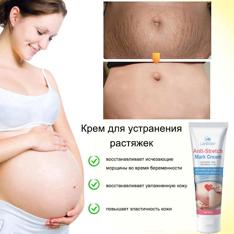 Крем от растяжек для беременных 60мл питательное увлажняющее средство по уходу за кожей против растяжек #1