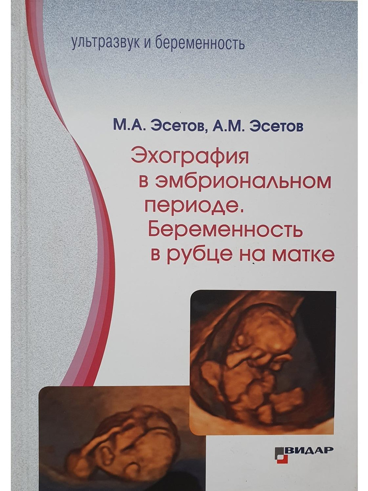Эхография в эмбриональном периоде. Беременность в рубце на матке  #1
