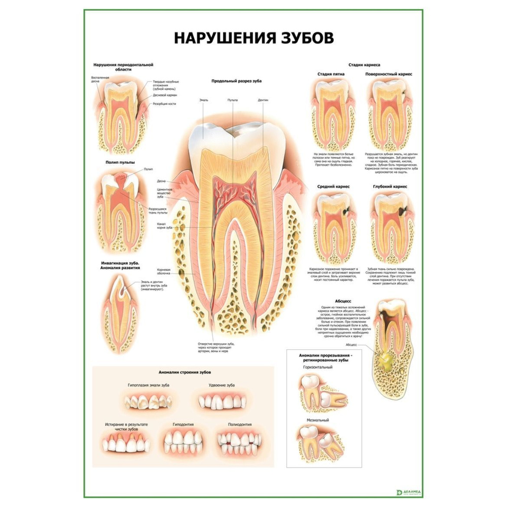 Обучающий медицинский плакат анатомия Нарушение зубов А2  #1