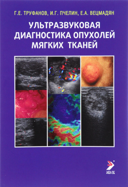 Ультразвуковая диагностика опухолей мягких тканей | Труфанов Геннадий, Пчелин Игорь Георгиевич  #1