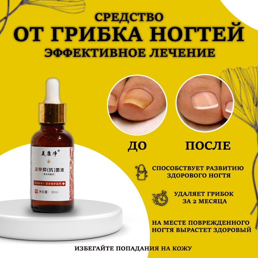 Масло для ногтей средство для лечения грибка и онихолизиса, 30мл ...