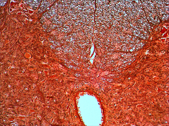 Нервные клетки под микроскопом