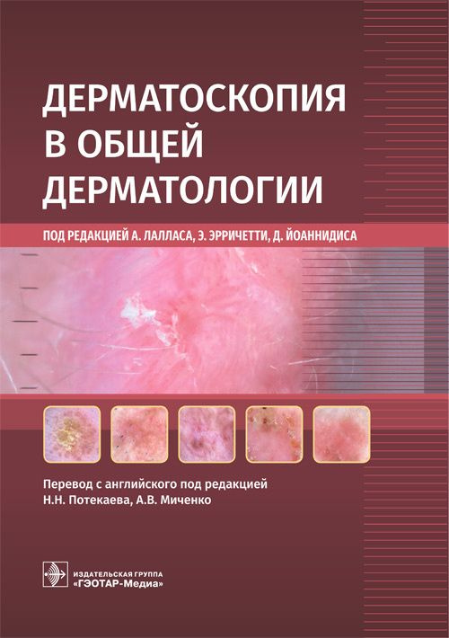 Книга: "Дерматоскопия в общей дерматологии". Медицинский учебник: Все о заболеваниях кожи: атопический #1
