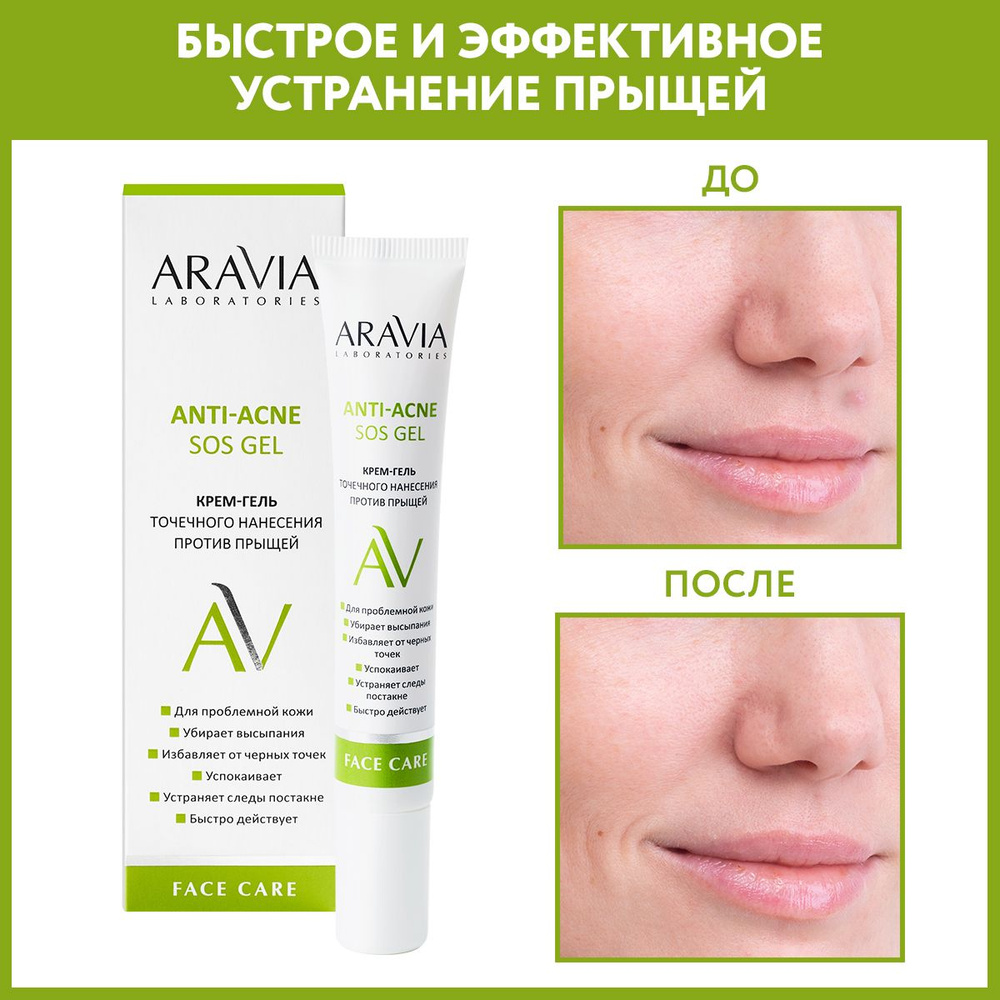 ARAVIA Laboratories Крем-гель точечного нанесения против прыщей Anti-acne SOS Gel, 20 мл  #1