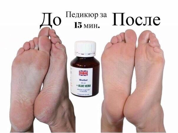 Биогель для удаления кутикулы и натоптышей BioGel Aloe Vera #1