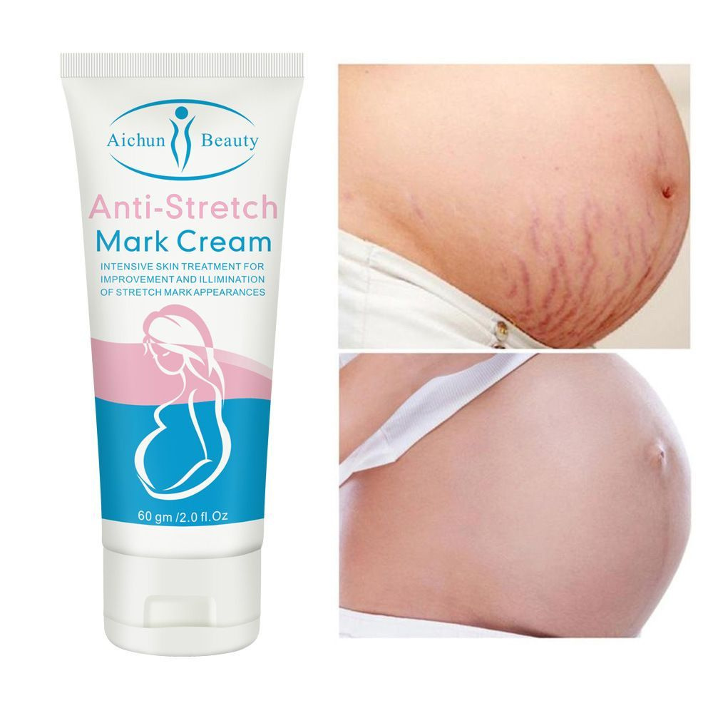 Anti-Stretch Mark Cream укрепляющий , крем укрепляющий от растяжек для беременных, 60 г  #1