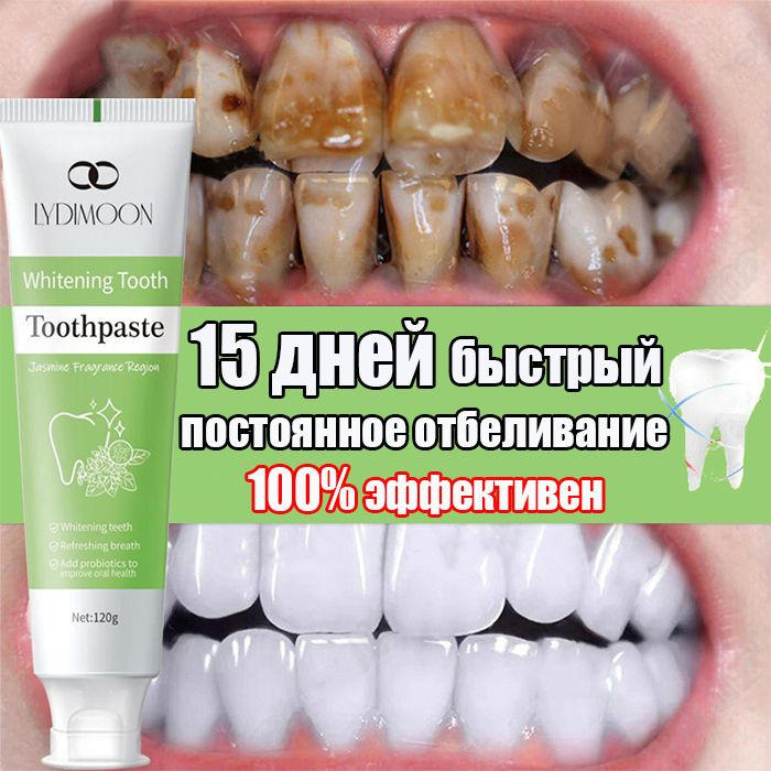Пробиотики Зубная паста отбеливающая,для чувствительных зубов, профилактика заболевания десен для эффективного #1