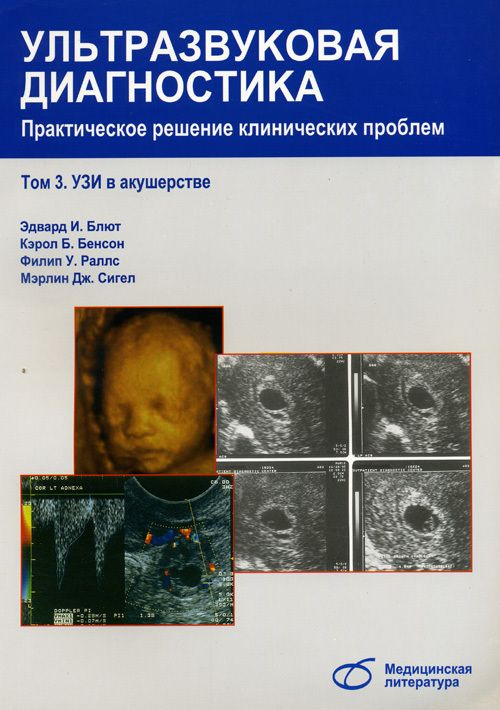 Ультразвуковая диагностика. Практическое решение клинических проблем. УЗИ в акушерстве. Руководство. #1