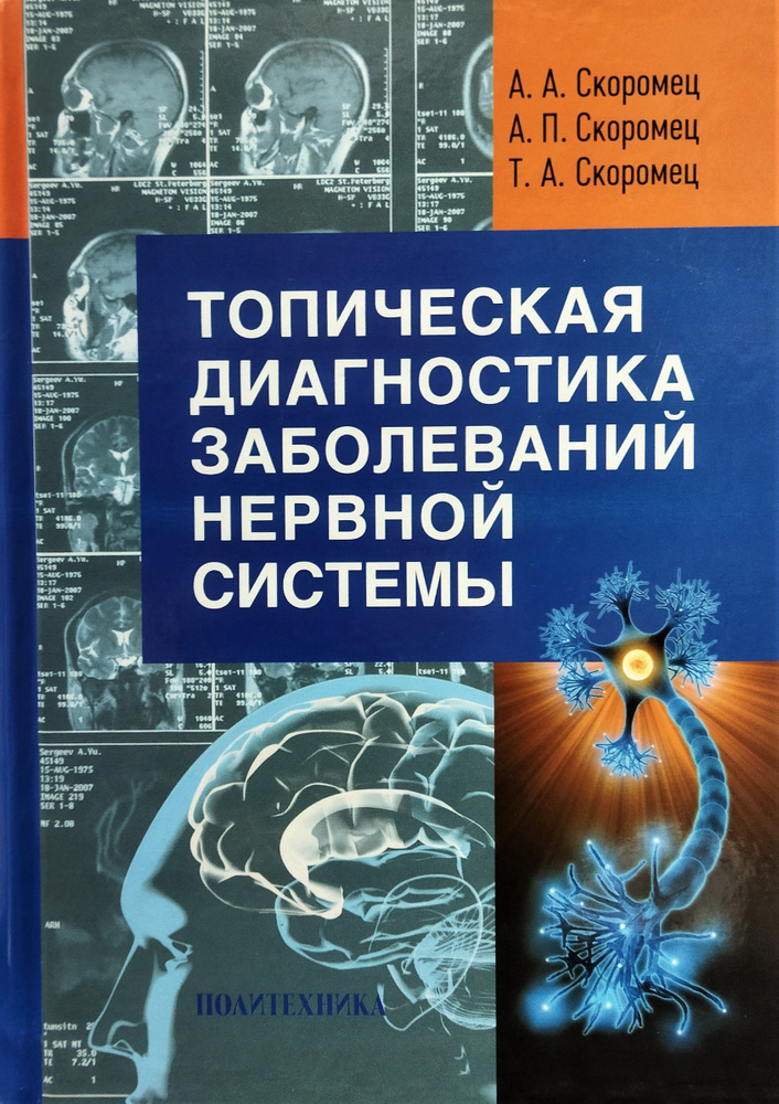 Топическая диагностика заболеваний нервной системы | Скоромец Александр Анисимович  #1