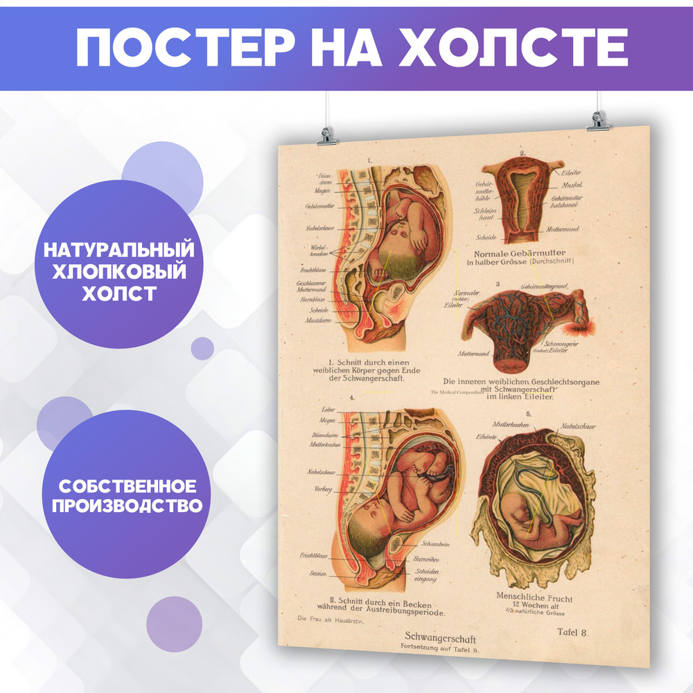 Постеры для интерьера на стену - в гинекологию, беременность, анатомия (3) 40х60 см  #1