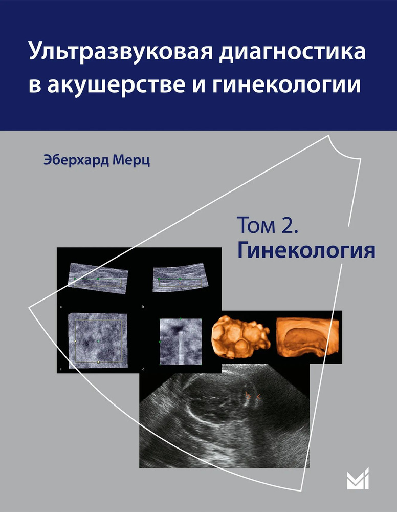 Ультразвуковая диагностика в акушерстве и гинекологии  #1