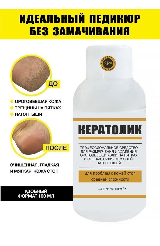 КЕРАТОЛИК ДЛЯ ПЕДИКЮРА для удаления огрубевшей кожи, мозолей и ...