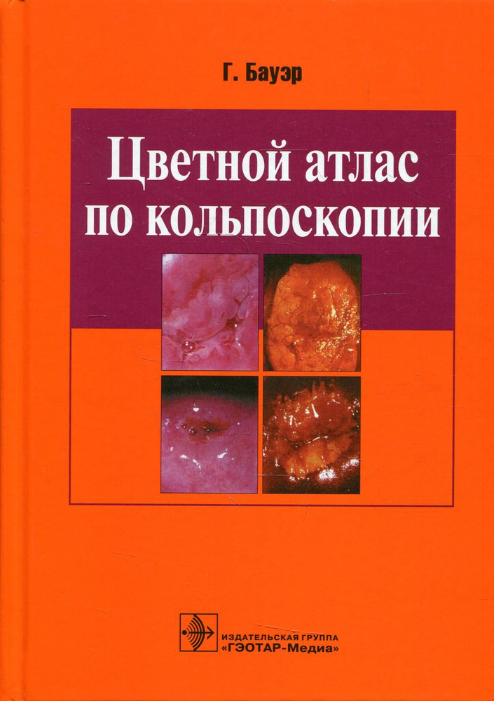 Цветной атлас по кольпоскопии #1