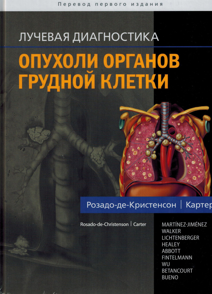 Лучевая диагностика. Опухоли органов грудной клетки - купить с ...