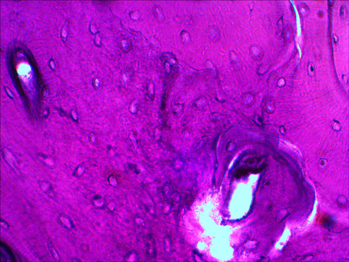 Костная ткань под микроскопом