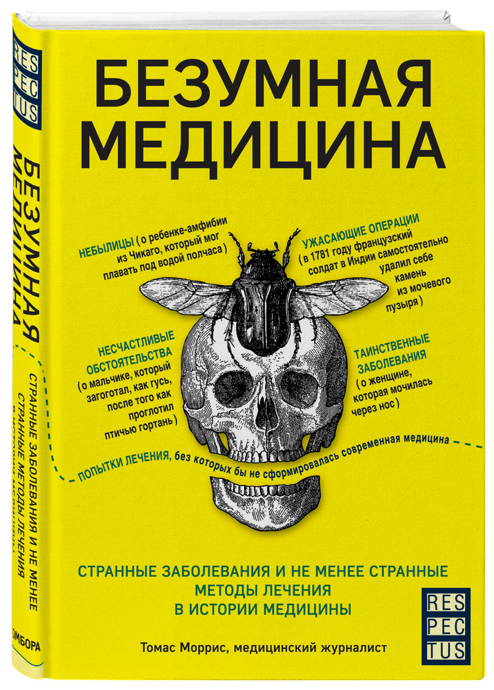 Безумная медицина. Странные заболевания и не менее странные методы лечения в истории медицины  #1