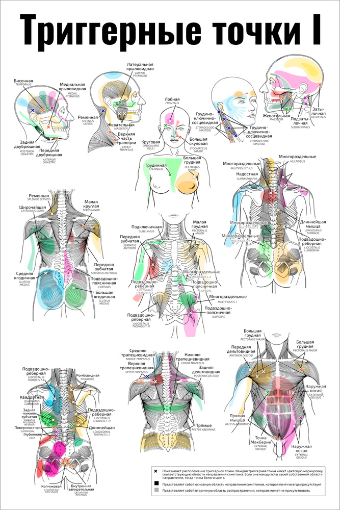 Плакат А2 ламинир. обучающий Триггерные точки I медицинский плакат по массажу, аккупунктуре, остеопатии #1