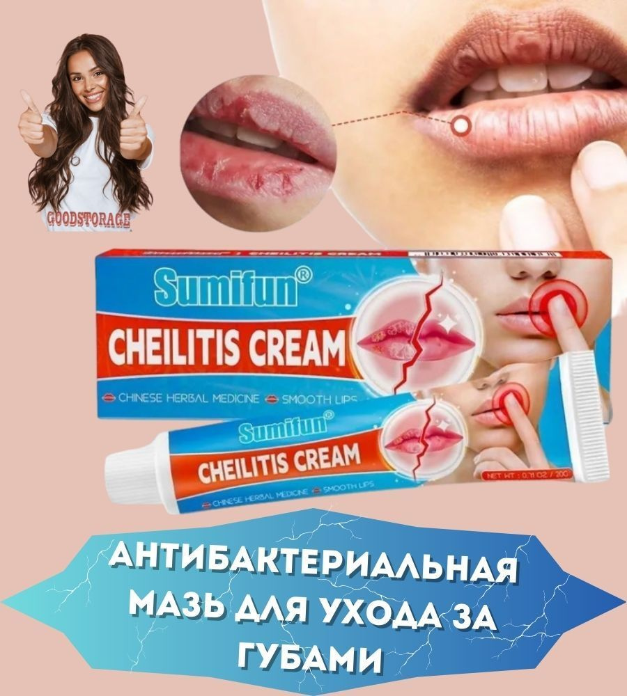 Антибактериальная мазь для ухода за губами, от холодов Cheilitis Cream  #1