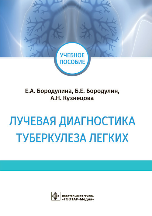 Лучевая диагностика туберкулеза легких | Кузнецова Алена Николаевна, Бородулин Борис Евгеньевич  #1