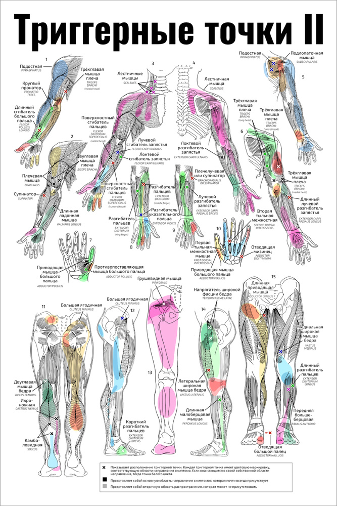 Плакат А2 ламинир. обучающий Триггерные точки II медицинский плакат по массажу, аккупунктуре, остеопатии #1