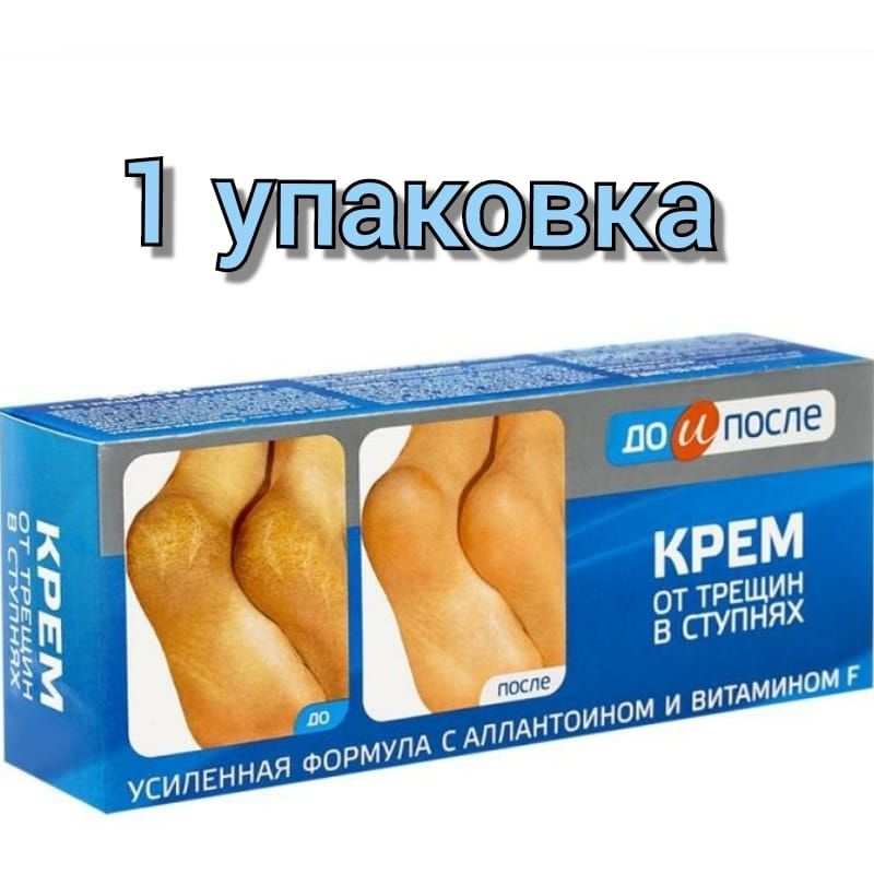 Крем для ног "До и После" от трещин в ступнях 50мл/1уп #1