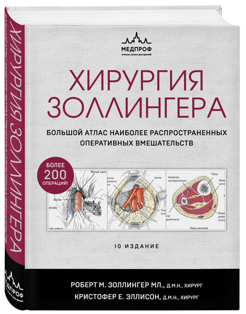 Хирургия Золлингера. Большой атлас наиболее распространенных оперативных вмешательств  #1