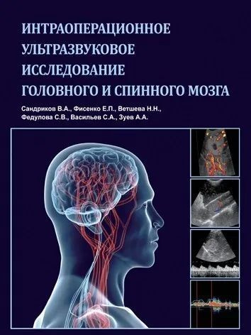 Интраоперационное ультразвуковое исследование головного и спинного мозга  #1