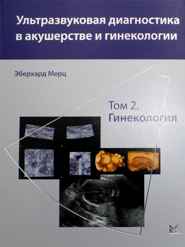 Ультразвуковая диагностика в акушерстве и гинекологии В 2 т. Т. 2: Гинекология 2-е изд. под общ. ред. #1