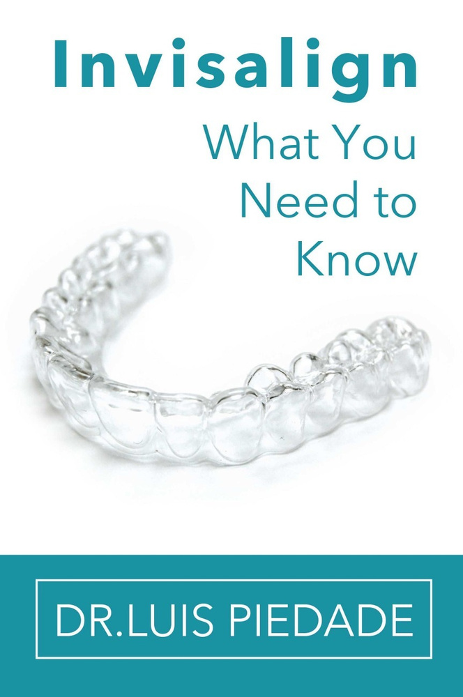 Invisalign. What You Need to Know #1