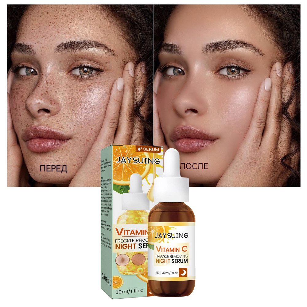 Отбеливающая эссенция от веснушек Витамин С устраняет пятна Осветляет ...