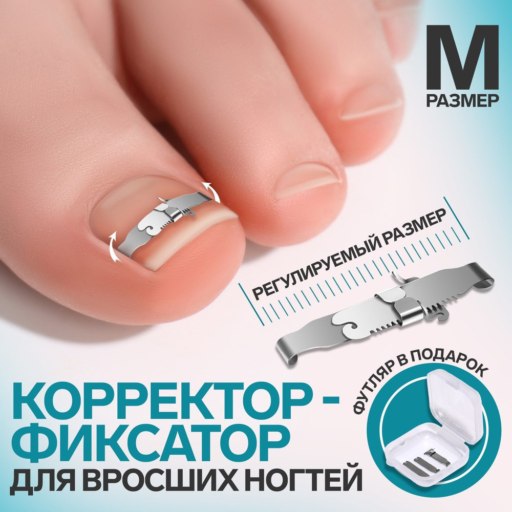 Корректор-фиксатор для вросшего ногтя, размер M, в пластиковом футляре, цвет серебристый  #1
