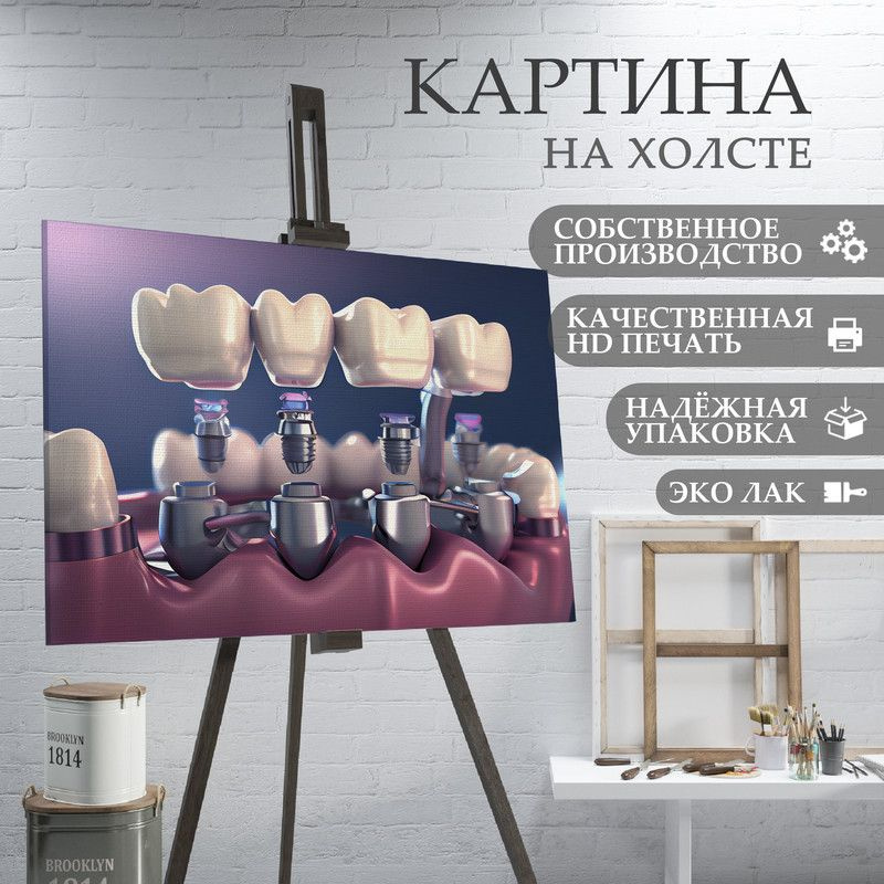 ArtPrintPro Картина "Зубы в стоматологию (18)", 80  х 60 см #1