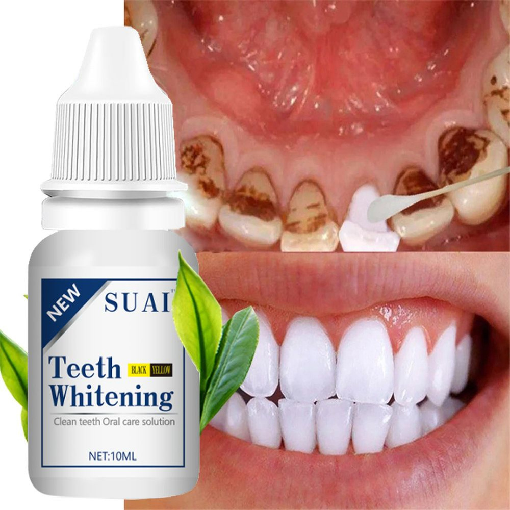 Gealfis teeth whitening artifact, юньнаньское травяное средство для чистки зубов, для удаления пятен #1