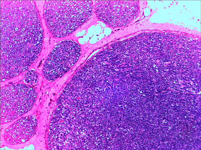Нерв (поперечный срез) под микроскопом