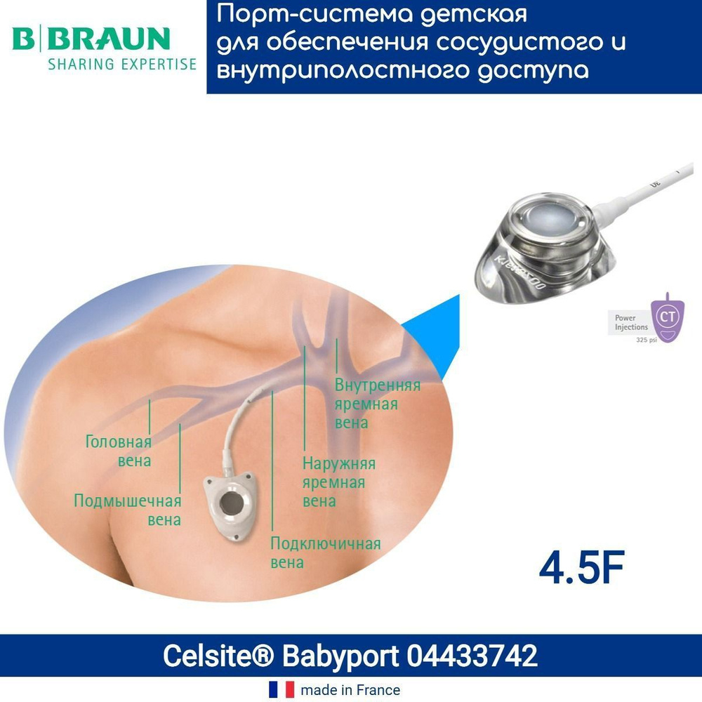 04433742 Венозная порт-система для химиотерапии Селсайт (B.Braun Celsite) Epoxy Babyport 4,5F/1,5 мм, #1