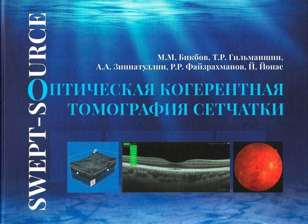 Оптическая когерентная томография сетчатки. Атлас- руководство | Зиннатуллин Айнур  #1