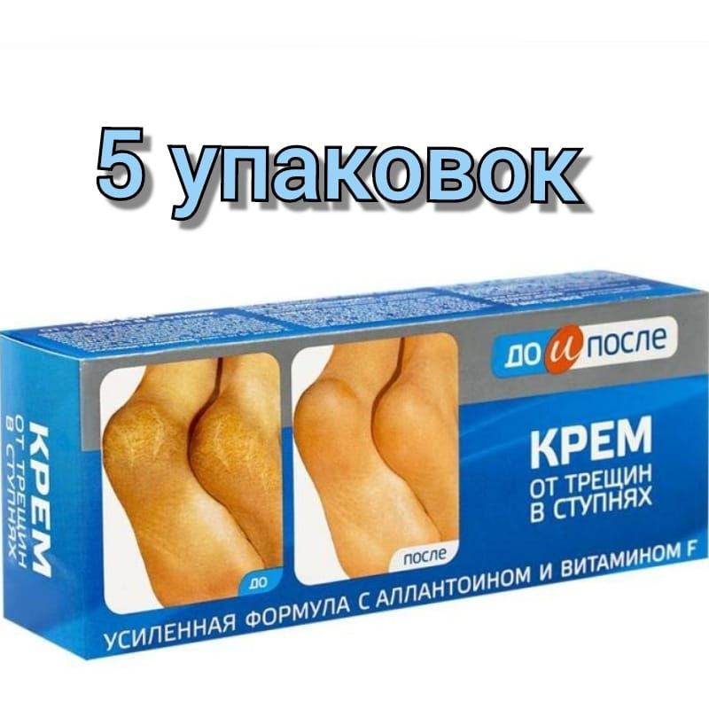 Крем для ног "До и После" от трещин в ступнях 50мл/5уп #1