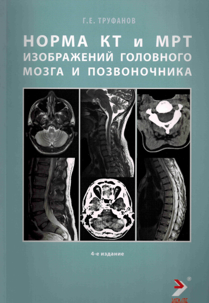 Норма КТ и МРТ изображений головного мозга и позвоночника. Атлас изображений. 4-е издание  #1