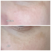 LIBREDERM DERMATOLOGY BRG+ВИТАМИН В3 Осветляющий регулярный крем от пигментных пятен для лица и тела 50 мл #40, ирина с.