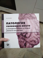 Патология головного мозга у новорожденных и детей раннего возраста | Власюк Василий Васильевич #2, Виктория