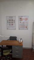 Плакат Стержневая мозоль для кабинета педикюра и подолога в формате А1 (84 х 60см), версия 2 #1, Мария В.