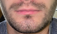 ROST BLACK 5% Средство для роста бороды волос и усов / Сыворотка против облысения у мужчин / Лосьон от выпадения волос #6, Александр Ц.