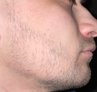 ROST BLACK 5% Средство для роста бороды волос и усов / Сыворотка против облысения у мужчин / Лосьон от выпадения волос #3, Александр Ц.