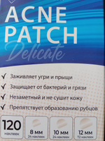 Патчи от прыщей против акне гидроколлоидные, меньше, чем пластырь, точечные наклейки acne набор 120шт #6, Екатерина Б.