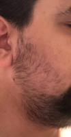Масло Hair Growth Serum / Сыворотка для роста волос, для бороды, восстановление, активатор роста, против выпадения, уход за волосами / 55 мл #37, Витя В.